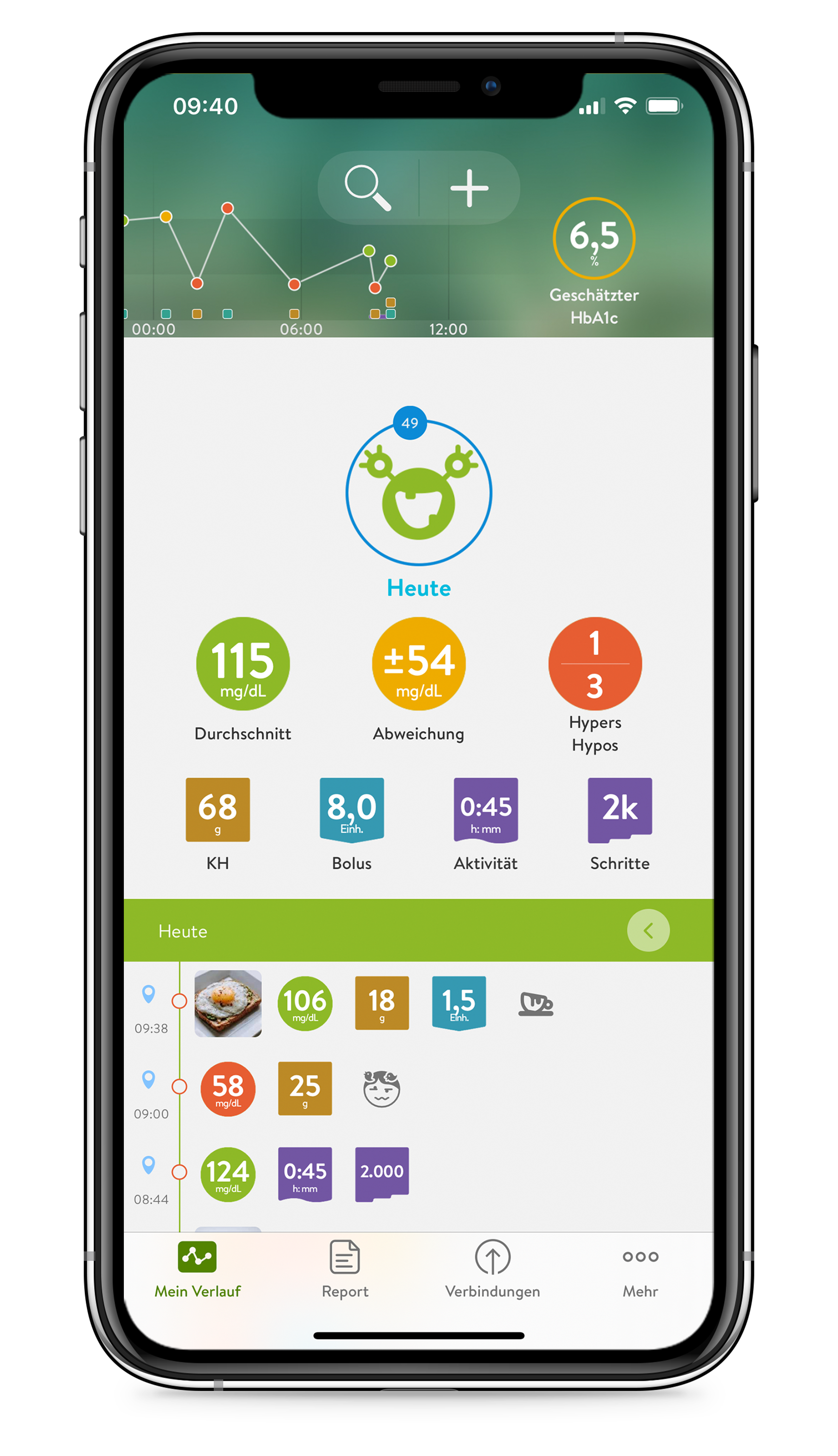mysugr