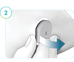 In der Abbildung ist dargestellt, wie der SmartGuide Sensor entfernt wird.