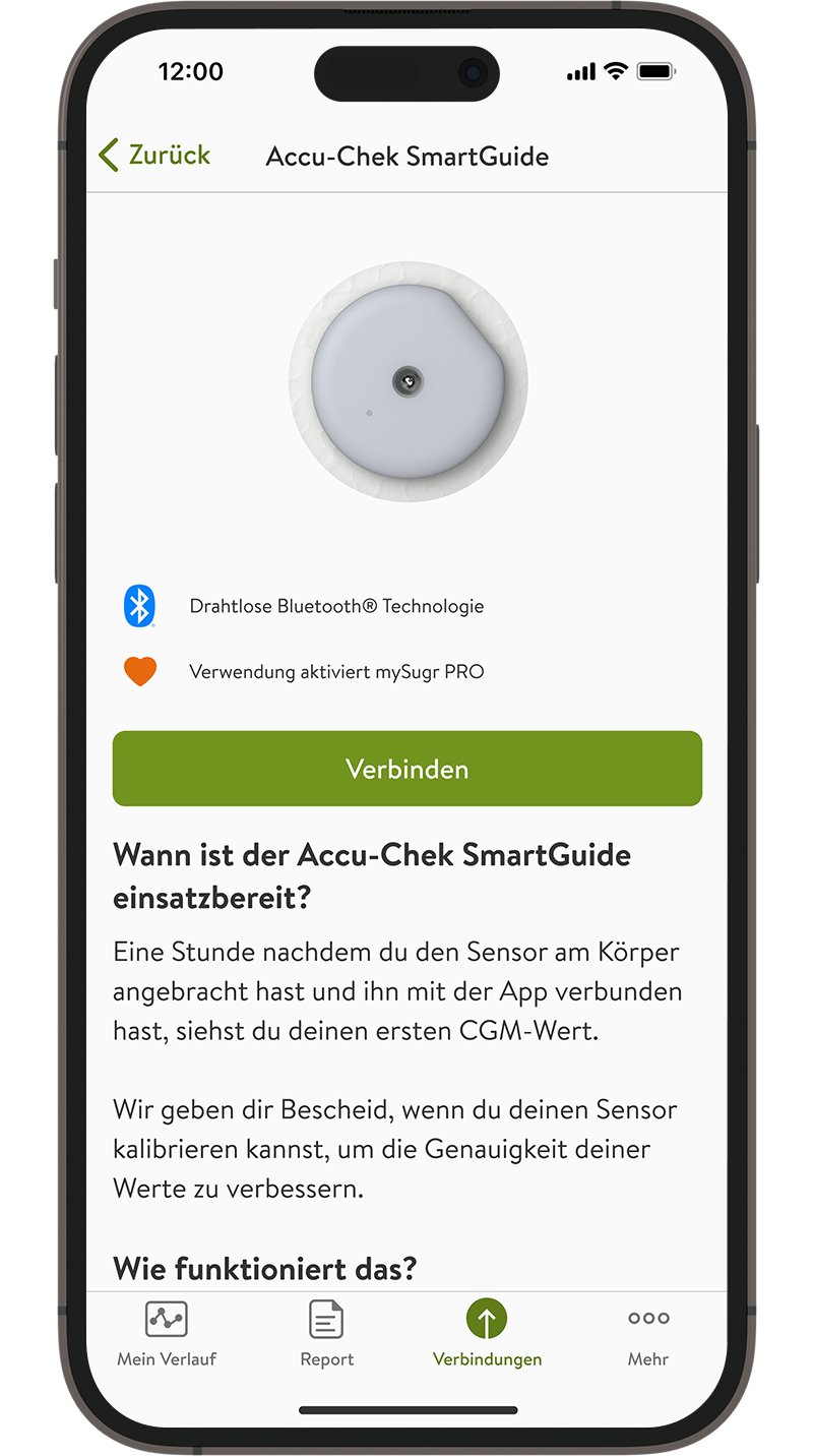 Screenshot der Anzeige zum Verbinden in der mySugr App.