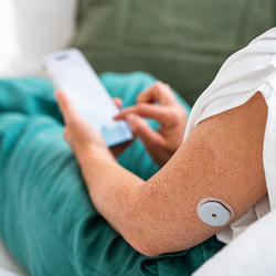 Kalibrierung und Aufwärmphase des Accu-Chek SmartGuide Sensors