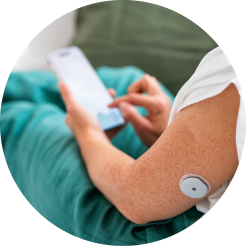 Arm mit aufgesetztem CGM-Sensor – Illustration zur kontinuierlichen Glukosemessung mit Accu-Chek SmartGuide